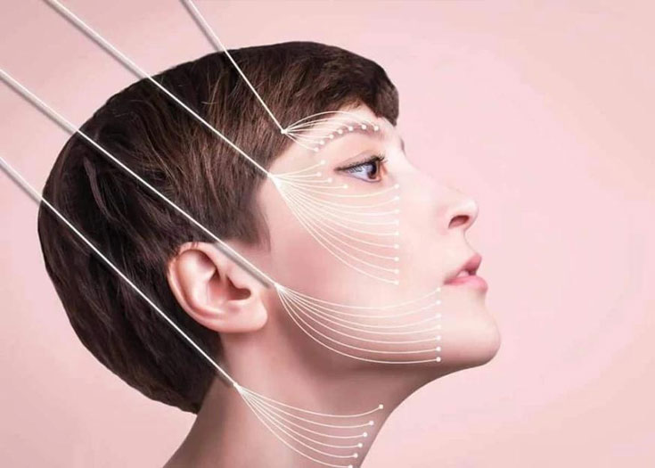 Yüz Germe Ameliyatı (Face Lift)